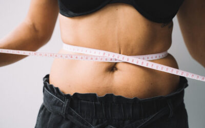 How to Avoid Loose Skin After Weight Loss in California